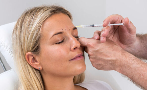 Botox gebruiken tegen rimpels